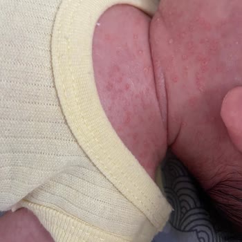 Mmt Amerikan Hastaneleri Tarsus Mmt Yeni Doğan Ünitesi Sorunları