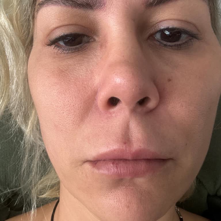 Estesante Clinic Estesante Güzellik Akasya Şikayeti