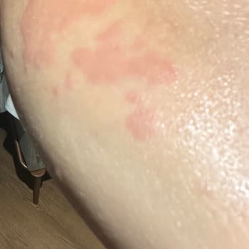 Obilet Tur Şirketi Haksiz Fazla Kesinti