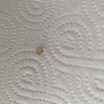 Knorr Hazır Çorbada Cam Parçası Tehlikesi