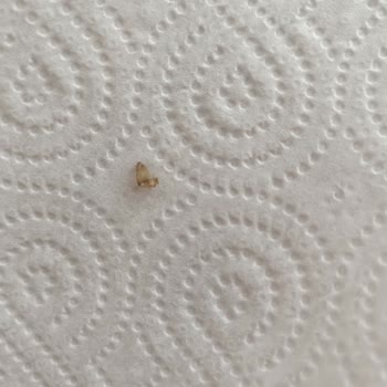 Knorr Hazır Çorbada Cam Parçası Tehlikesi