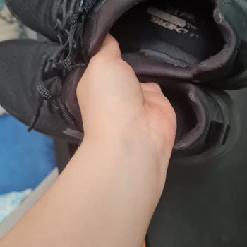 1 Ayda Ayakkabı Yırtıldı Skechers