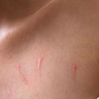 Trendyol'dan Aldığım Kedi Yatağı Güvenlik Sorunu Yarattı