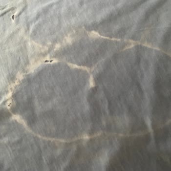 Vanish Kosla Leke Çıkarıcı Şikayeti!