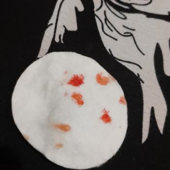 Kadıköy Clinical Yanlış Dudak Dolgusu Steril Olmayan İşlem