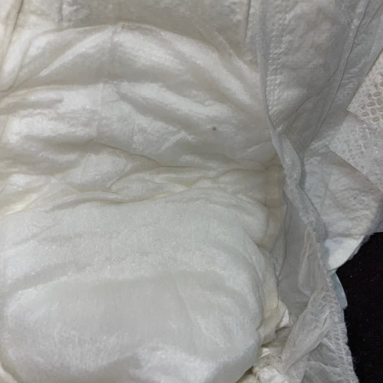 Sleepy Bezde Siyah Noktaların Olması