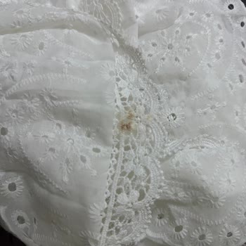 Xoxo Store Beklentileri Karşılamayan Etek Deneyimi