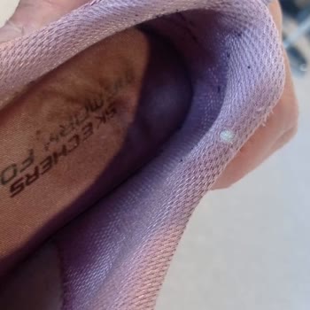 Skechers Ayakkabı Kalitesizliği Ve Müşteri Hizmetleri Sorunu