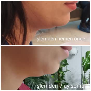 Eki aç