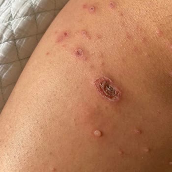 Global Yurtdışı Eğitim Kızımın Yurt Dışı Eğitim Deneyimi Kabusa Döndü!