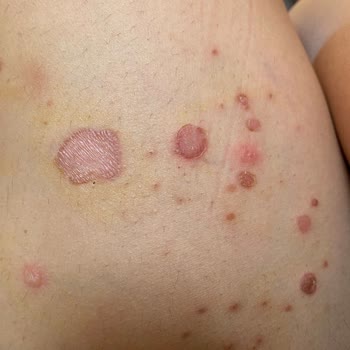 Global Yurtdışı Eğitim Kızımın Yurt Dışı Eğitim Deneyimi Kabusa Döndü!