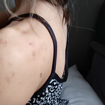 Aris Güzellik Merkezleri Güzellik Merkezi Deneyimi Ve Sonuçları