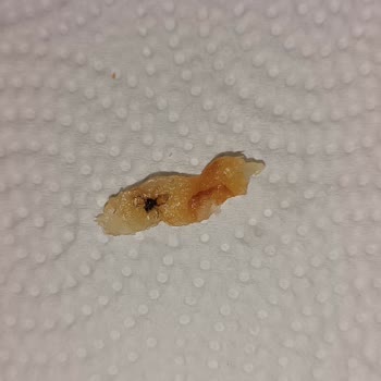 Ufuktepe Platin Pastanesi Poğaça Da Böcek Var