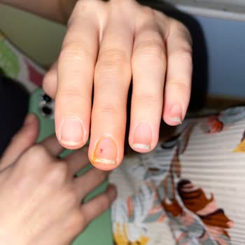 Mustafa Kirazoğlu Devlet Hastanesi İnsan Sağlığı İle