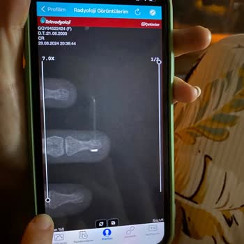 Mustafa Kirazoğlu Devlet Hastanesi İnsan Sağlığı İle