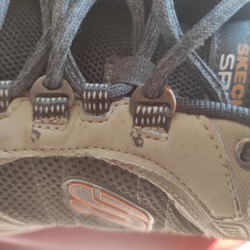 Skechers Ayakkabıda Kalite Sorunu Ve Yetersiz Müşteri Hizmeti
