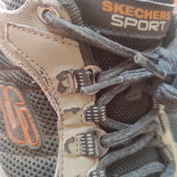 Skechers Ayakkabıda Kalite Sorunu Ve Yetersiz Müşteri Hizmeti