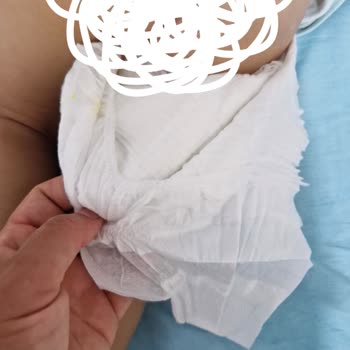 Molfix Bez Çiş Çıkartma