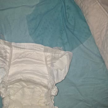 Molfix Bez Çiş Çıkartma