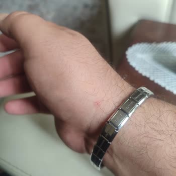 Nomination Bileklik Kullanımında Yaşanan Rahatsızlıklar