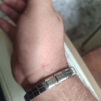 Nomination Bileklik Kullanımında Yaşanan Rahatsızlıklar