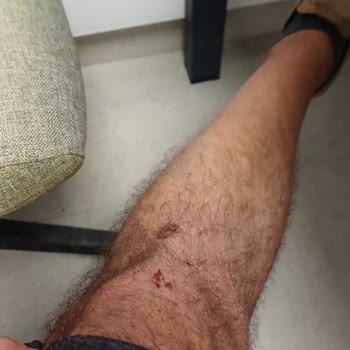 Sunshine Holiday Resort Memnuniyetsizliği