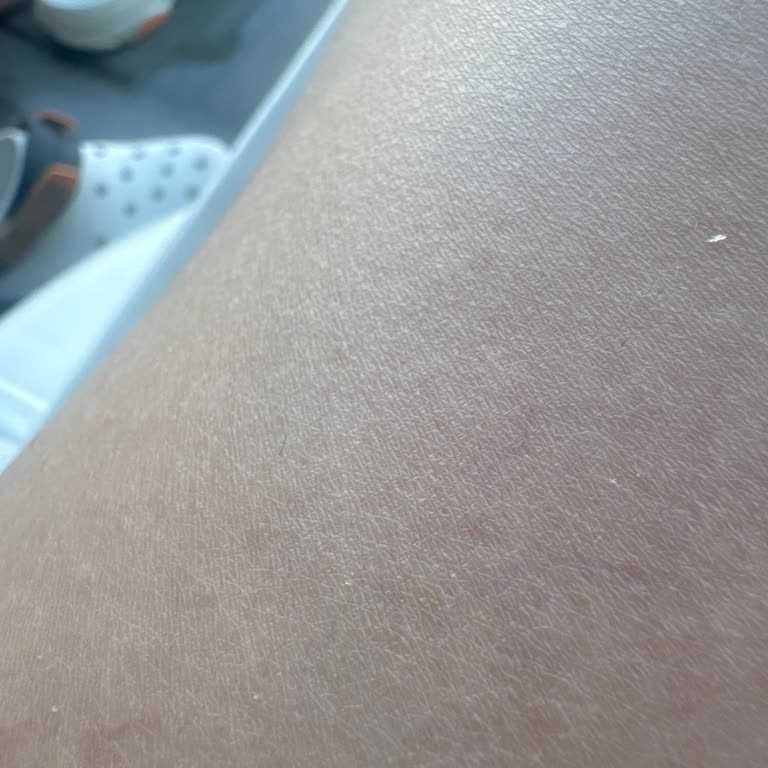 Climed Klinik Yanlış Tedavi Sonucu Bacaklarımda Kalıcı Hasar Oluştu