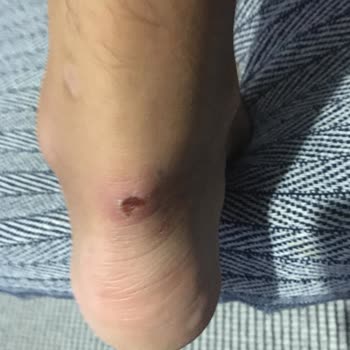 Cz London Ayakkabı İle İlgili Hüsranımız