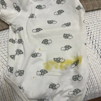 Prima Premium Care 2 Numara Sırttan Kaka Sızdırıyor