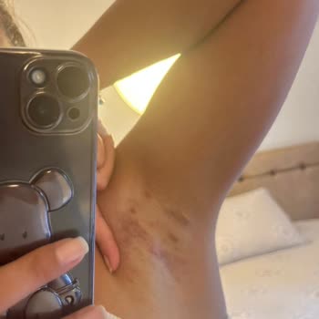 Watsons Rexona İnsan Sağlığıyla Oynuyor