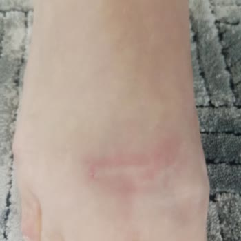 Derimod Ayakkabı Rahatsızlığı Ve İade Talebi