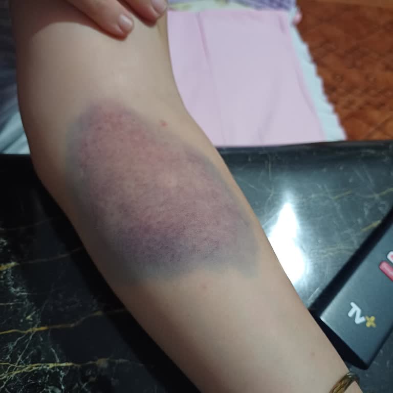 Zonguldak Bülent Ecevit Üniversitesi Hastanesi Zonguldak Hastanesi Tıp Fakültesi Hasta Deneyimi