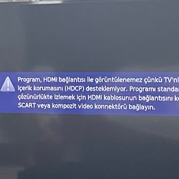Digiturk Dhcp HDMI Sorunu?