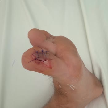 Afytos Park Ören Afytos Mtk Ören, Yok Mu Ayağımı Gören.