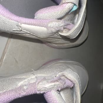 Adidas Bu Durum Nasıl Kullanıcı Hatası Olabilir.?