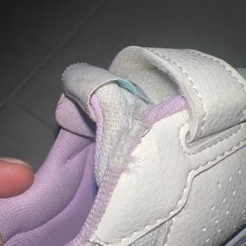 Adidas Bu Durum Nasıl Kullanıcı Hatası Olabilir.?