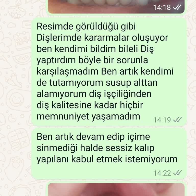 Dent Effect Diş Sağlığı Polikliniği Zirkonyum Kaplama Ticari Doktorlar