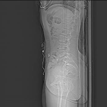 Quick Sigorta Manevi Tazminat Ödememe