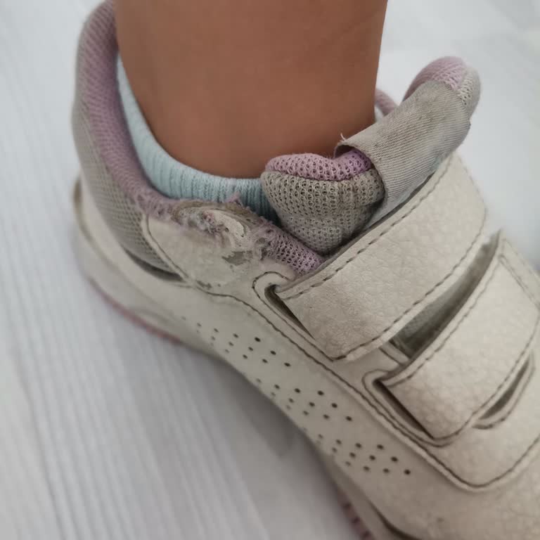 Adidas Çocuk Ayakkabısı Astar Yırtılması