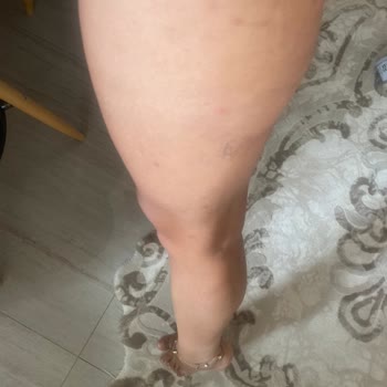 Hotel Samara 5 Yıldızlı Otelde Kadına Şiddet Ve Buna Duyarsız Kalan Otel Yetkililer