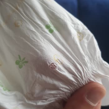 Baby Turco A101'den Aldığım Bebek Bezleri Sürekli Akıntı Yapıyor