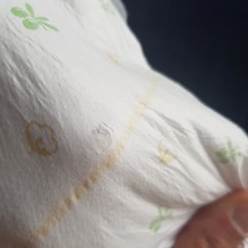 Baby Turco A101'den Aldığım Bebek Bezleri Sürekli Akıntı Yapıyor