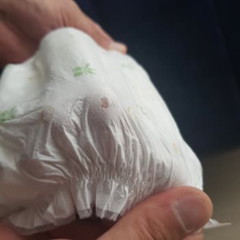 Baby Turco A101'den Aldığım Bebek Bezleri Sürekli Akıntı Yapıyor