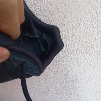 Adidas Shoes Deformed Within a Year and Adidas Isn't Providing Any Support