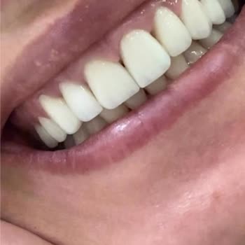 Özel Diyalog Diş Kliniği Ümraniye Yetersiz Bilgilendirme Ve Tedavi Sorunları