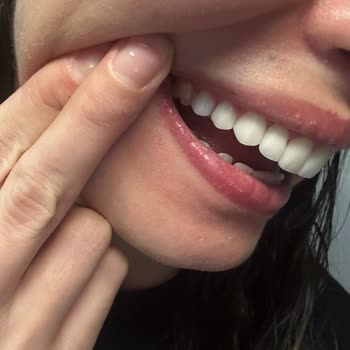 Özel Diyalog Diş Kliniği Ümraniye Yetersiz Bilgilendirme Ve Tedavi Sorunları