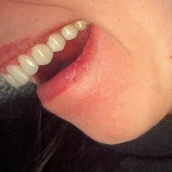 Özel Diyalog Diş Kliniği Ümraniye Yetersiz Bilgilendirme Ve Tedavi Sorunları