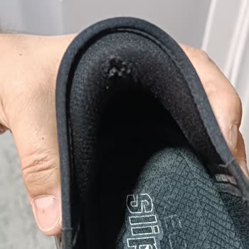 Skechers Marka Ayakkabıda Topuk Yırtılması Sorunu