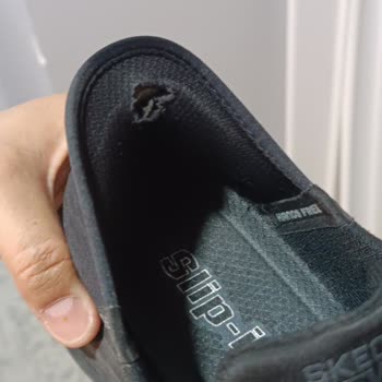 Skechers Marka Ayakkabıda Topuk Yırtılması Sorunu