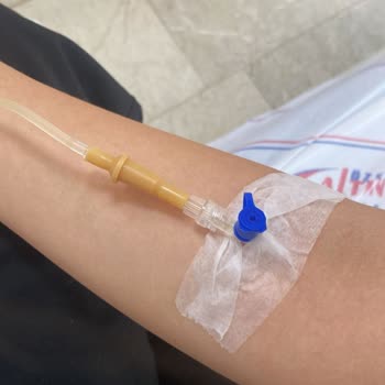 Altınkoza Hastanesi Serum Taktırma Sonrası Damar Problemi